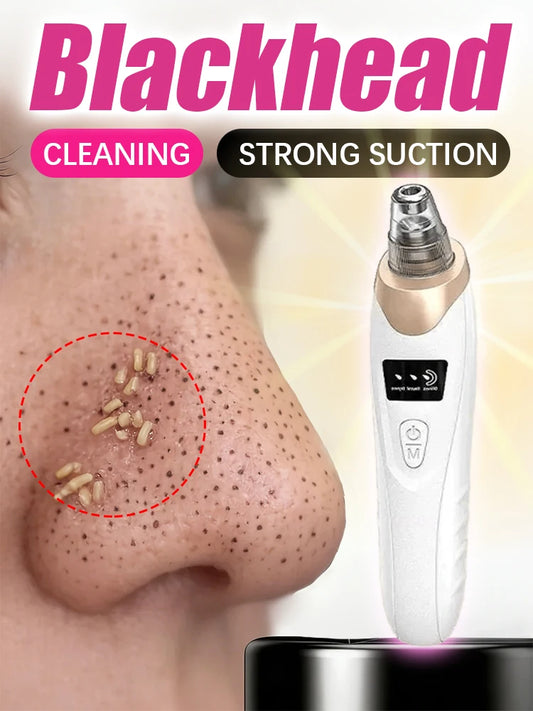 Power Pore Vacuum Blackhead Remover