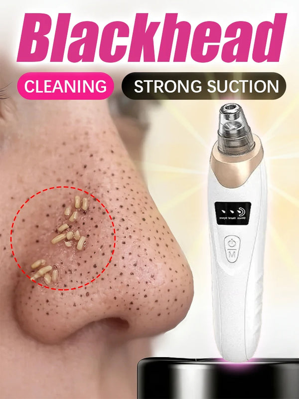 Power Pore Vacuum Blackhead Remover